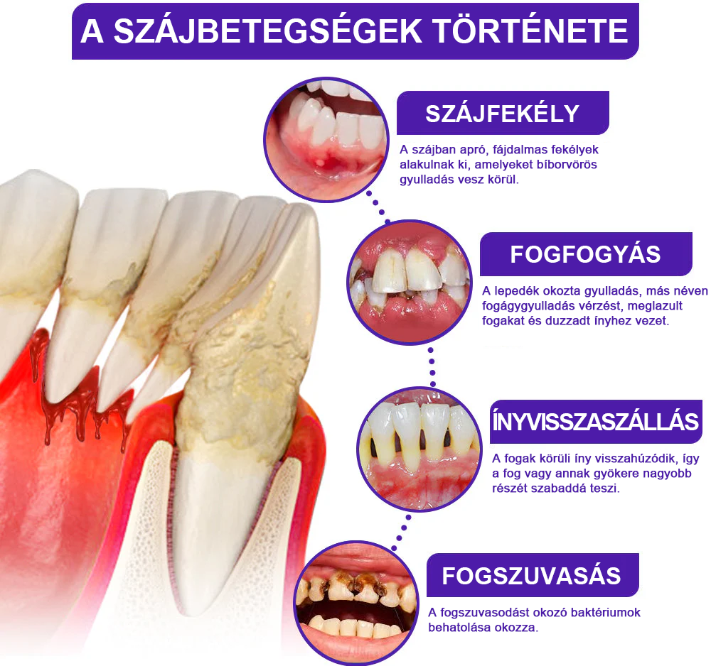 🌟Rolimey® VioCore fogkrém méhméreggel
