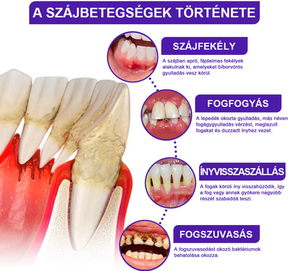 🌟Rolimey® VioCore fogkrém méhméreggel
