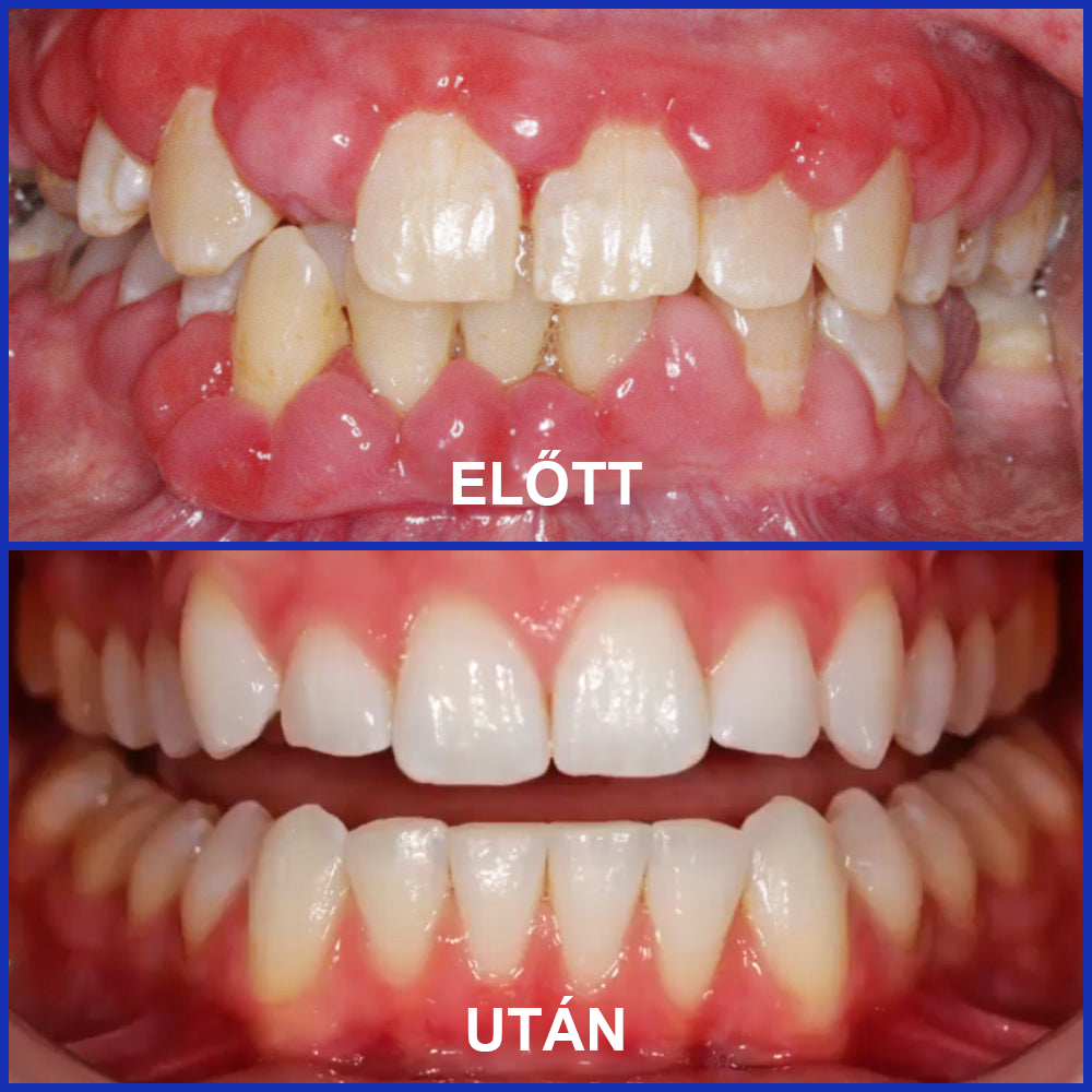 🌟Rolimey® VioCore fogkrém méhméreggel