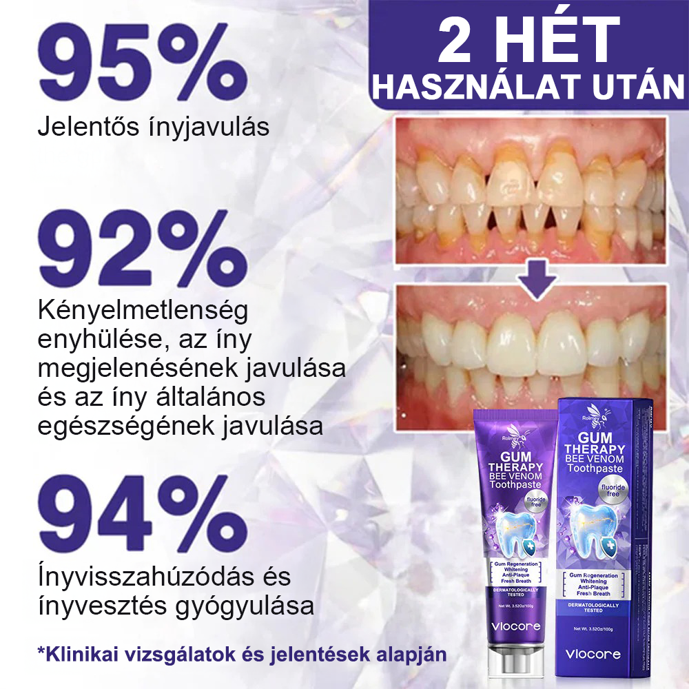 🌟Rolimey® VioCore fogkrém méhméreggel