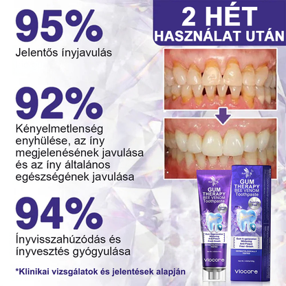 🌟Rolimey® VioCore fogkrém méhméreggel