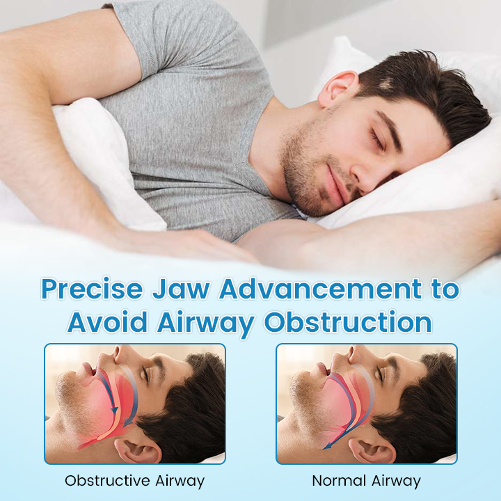😴 Flanora Anti-Snoring Device: Reduce Snoring From First Night! ✨
