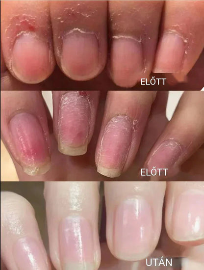 💅🥰Új frissített 3 az 1-ben körömápoló toll